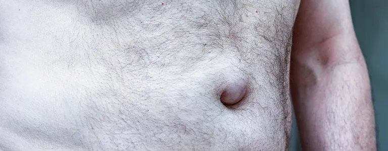 especialista en hernias