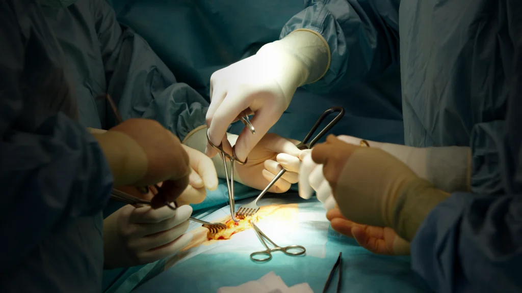Cirugía de Hernia Inguinal en Pachuca